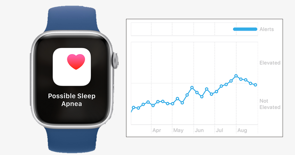 fitur sleep apnea Apple Watch fitur sleep apnea Apple Watch